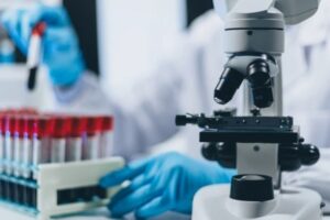 Τι είναι η πλασμαφαίρεση και οι θεραπείες με βλαστοκύτταρα CD34+, πώς γίνεται η διαδικασία